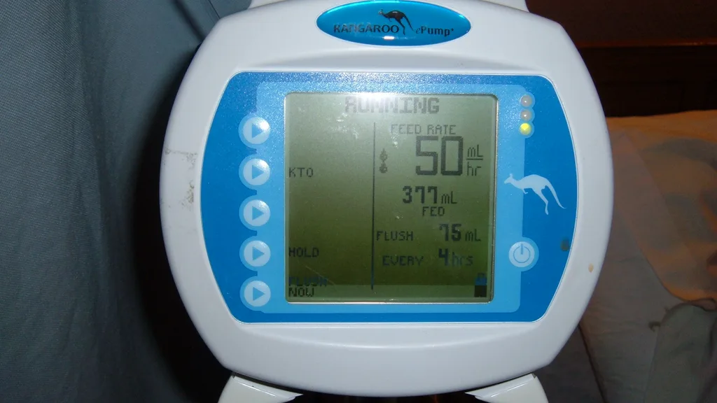 An intravenous infusion line and bag